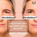 Levanta Parpados