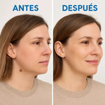 Kit Removedor de Verrugas